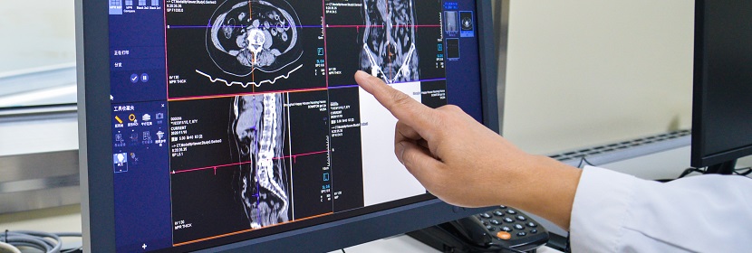X射線計算機體層攝影(CT)裝置放射衛生檢測評價