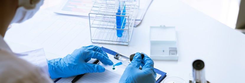 固定室?guī)秸婵者^濾機(jī)用橡膠濾帶檢測